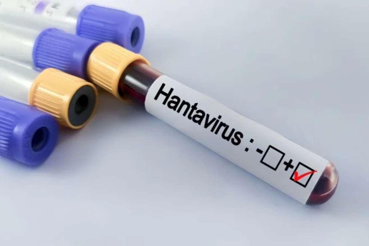 Czym jest hantawirus i jak się przenosi? Czym jest hantawirus i jak się przenosi?